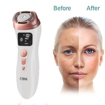 Mini Hifu Skin Care Machine Ultrasound Rf Facial Beauty Device Face Lift - £55.30 GBP+