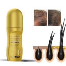 Vitamin Biotin Hair Growth Product Prevent Hair Loss Oil Scalp Treatment For Men - £15.02 GBP