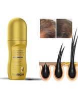 Vitamin Biotin Hair Growth Product Prevent Hair Loss Oil Scalp Treatment... - £14.81 GBP