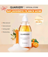 Quarxery Mite and Acne Body Wash 250ML New - €36,08 EUR