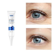 Hyaluronic Acid Eye Cream Remove Dark Circles Wrinkles Anti Puffiness Tr... - £11.64 GBP