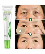 Crema hidratante para ojos con aloe vera Elimina las ojeras bolsas de... - £10.21 GBP