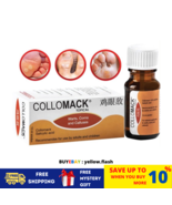 COLLOMACK TOPICAL 10ml Painless Remover Plantar Warts Corns And Calluses - $408.39 MXN