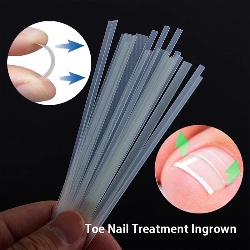 5Pcs Ingrown Toe Nail Treatment Ingrown Toenail Correction Tool Elastic Patch - £9.52 GBP+