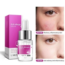 Anti-Allergic Serum Herbal Facial Essence Anti-Redness Shrink Pores Soothe Skin - £11.83 GBP