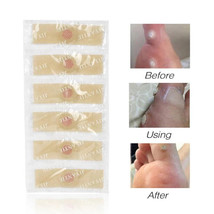 12) BEST Foot Corn Remover Pads Plantar Wart Thorn Plaster Patch Callus Removal - £4.68 GBP