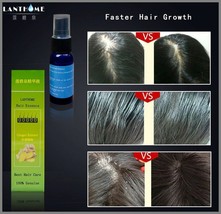 Anti Hair Loss Growth Liquid Spray for Women Men Regrowth Repair Treatment Serum - £6.30 GBP
