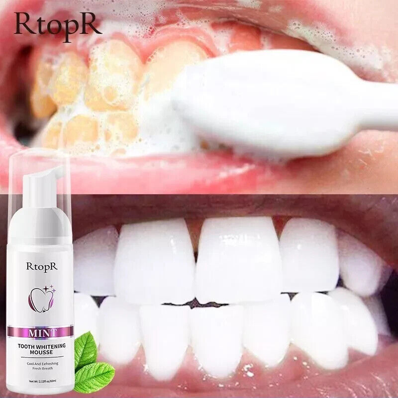 RtopR Tooth Whitening Mousse Removes Stains Teeth Essence Fresh Clean Br... - $7.91