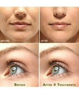 Vitamin C &amp; Hyaluronic Acid Anti-Aging Serum Anti Aging Cream Face ,Eye ... - $11.95