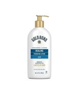 Gold Bond Aloe Healing Lotion (14oz) - $12.38