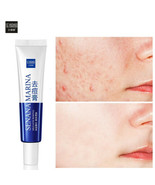 2 Pack Acne Removal Nicotinamide Cream Aloe Vera Oil Control Shrink Pores - $9.89