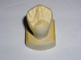 Dental Tooth Model Plaster Cast Anatomy Morphology Teaching Lower 1st Bi... - $19.99