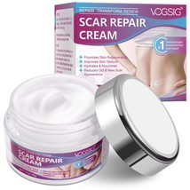 Scar Cream Scar Removal Cream Rapid Repair of New Old Scars,Burns All Na... - $284.91 MXN