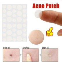 36pcs/set Hydrocolloid Acne Invisible Pimple Master Patch Skin Tag Removal Patch - $7.13+