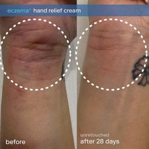 Eczema+ Ceramide Hand + Foot Relief Cream - $999.75 MXN