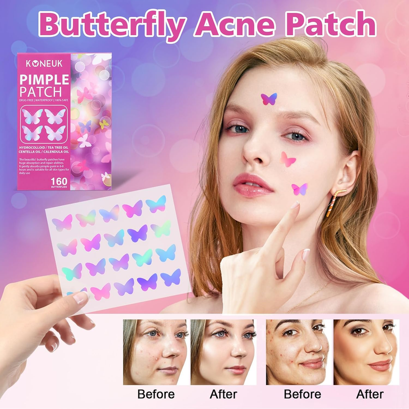 Acne Pimple Patches for Face (160 Counts), Hydrocolloid Acne Patches with Tea Tr Item image 3