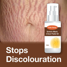 Fade Away Stretch Mark &amp; Scar Fade Oil – Max Strength Stop Signs Of Stretchy&#39;s - £18.83 GBP