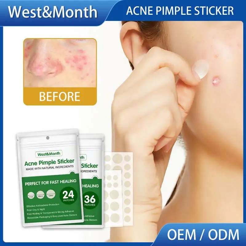 Sporting 24/36 Pcs Acne Pimple Patch Invisible Stickers Acne Treatment Pimple Re - £23.51 GBP
