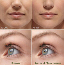 Hyaluronic Acid Gel Cream - Anti-Aging Wrinkle Face &amp; Eye (HA) Serum Moisturizer - £8.33 GBP