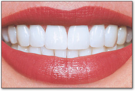 Perfect Teeth &amp; Smile 4X Spell Casting White Magick Wicca Pagan Beauty Ritual - £27.64 GBP