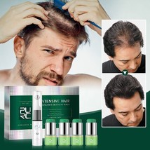 Hair Growth Product Hair Loss Scalp Massage Treatment Ginger Ginseng Ser... - $23.92