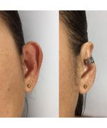 Protruding ear corrector EARCLIC - £39.50 GBP