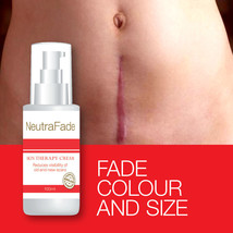 Neutra Fade Skin Therapy Cream Reduces Visibility Of Scar Cream – 100% Safe - £21.42 GBP