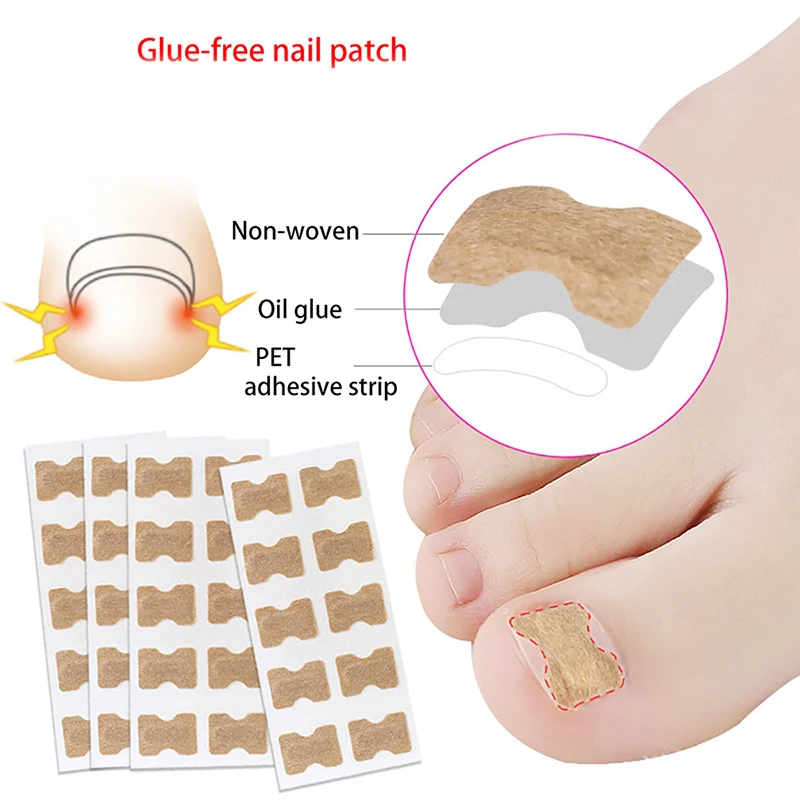 50/100Pcs Ingrown Toenail Toe Correction Stickers Nails Art Foot Patches Feet - £9.06 GBP+
