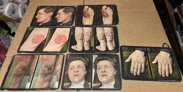 1910 Antique Medical Diagnosis Treatment Stereoscopic 6 Cards Dr. Rainfo... - $336.46 CAD