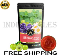 TEACURRY Acne Tea (1 Month Pack, 100 Grams Loose) Acne Removal Tea - $28.99