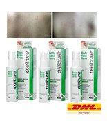 3 Oxe Cure Body Spray Reduce Blemish Treatment Acne on Back Chest Neck S... - $49.99