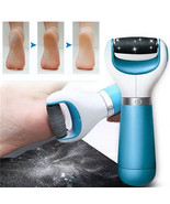 Electric Foot File Scraper Callus Remover - $25.91 CAD