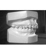 Dental gypsum powder tipe IV 1.7 LBS ( crow , bridge , acrylic resin ) m... - $10.17