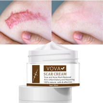 VOVA Scar Cream - Natural Scar Removal Skin Repair Anti-Inflammatory 30ml - £7.07 GBP