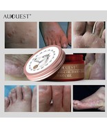 Anti Crack Foot Cream Itch Reliever Heel Cracked Repair Cream Removal Ca... - $11.76 CAD