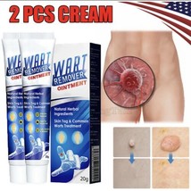 2X Wart Remover Ointment Genital Herpes Genital Antibacterial Treatment Cream US - £7.98 GBP