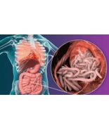 Intestinal Worms Tincture - $644.37 MXN