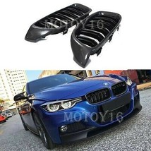 For BMW 3 Series F30 F31 M3 Style Front Upper Carbon Grill Grille 320i 320d 12+ - £63.52 GBP