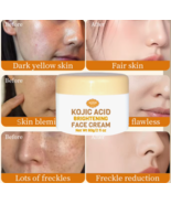 Crema blanqueadora para manchas marcas de acné para hombre y mujer 50g - $24.62 CAD