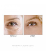 M. Asam Retinol Intense Eye Balm Against Wrinkles And Signs of Aging 15ml - $20.78