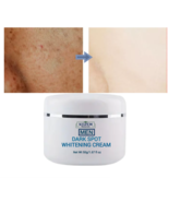 Crema blanqueadora de manchas oscuras para hombres 50 g - $24.95