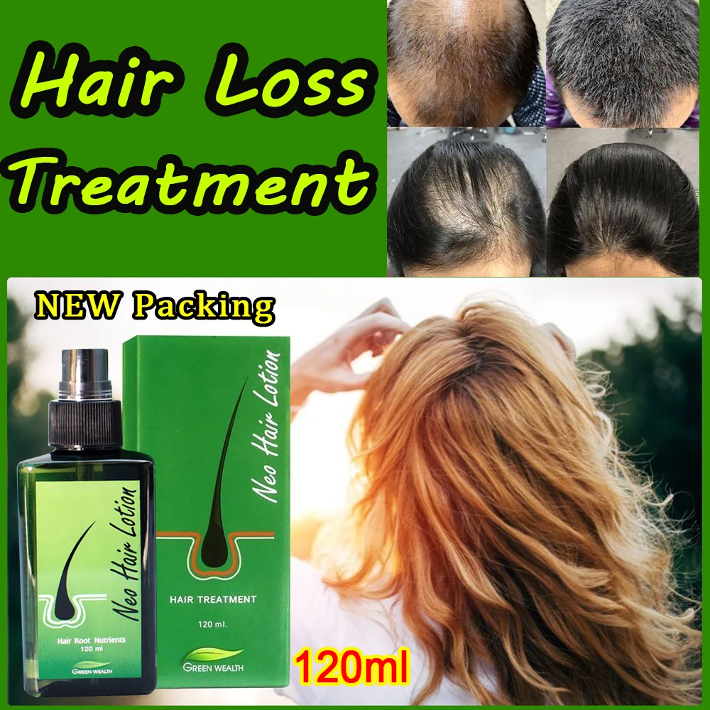 House Home neo hair lotion hair care A hair grow Serum essential hair loss treat - £24.41 GBP