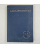 Atlas Of Surgical Operations Fourth Edition Cutler &amp; Zollinger MacMillan... - £22.66 GBP