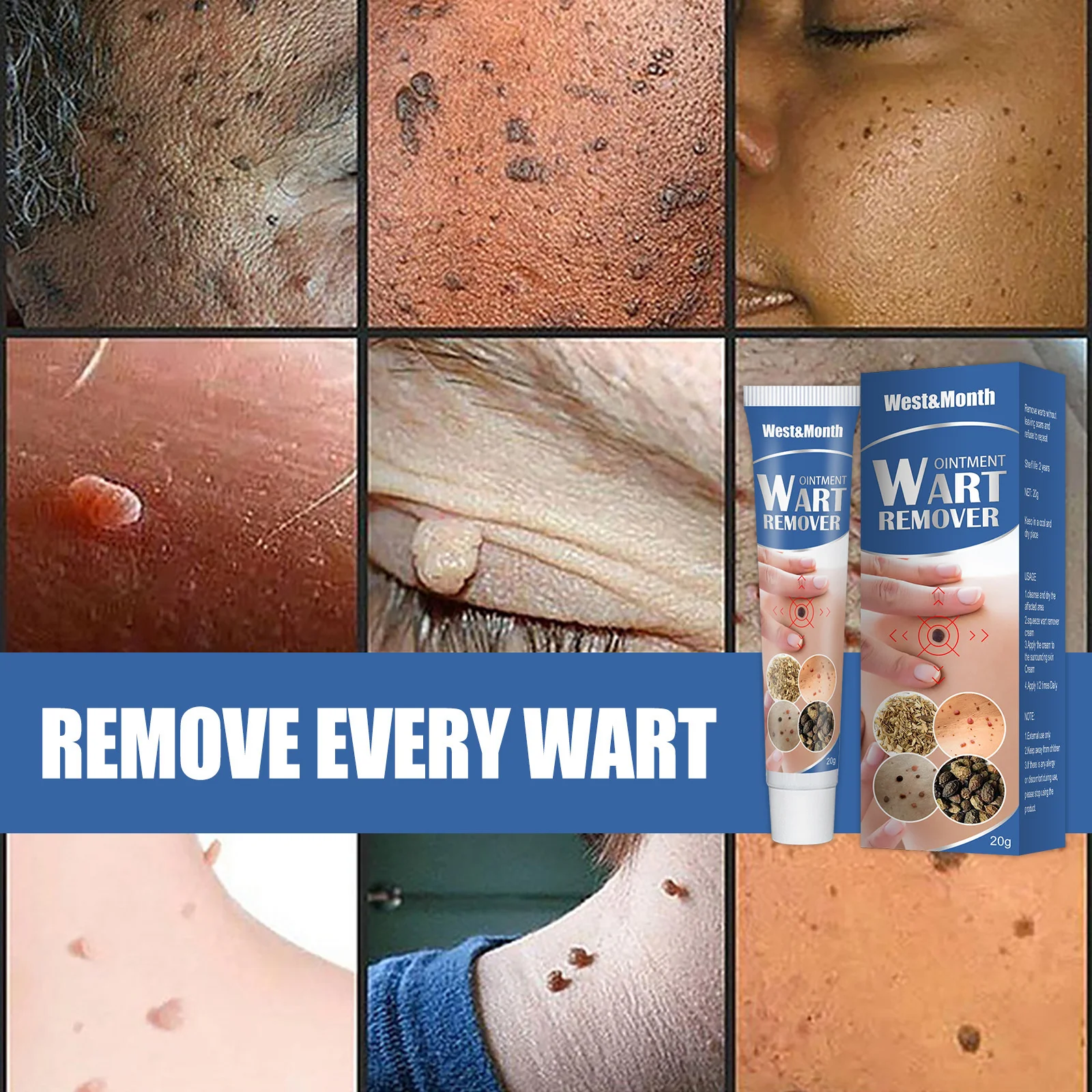 Warts Remover Cream Herbal Treatment Skin Tag Neck Armpit Flat Genital Corn Wart - £101.52 GBP