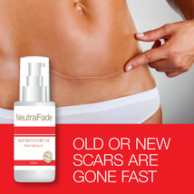 Neutra Fade Skin Recovery Oil Scar Fading Oil – Old Or New Scars Are Gone - £21.42 GBP