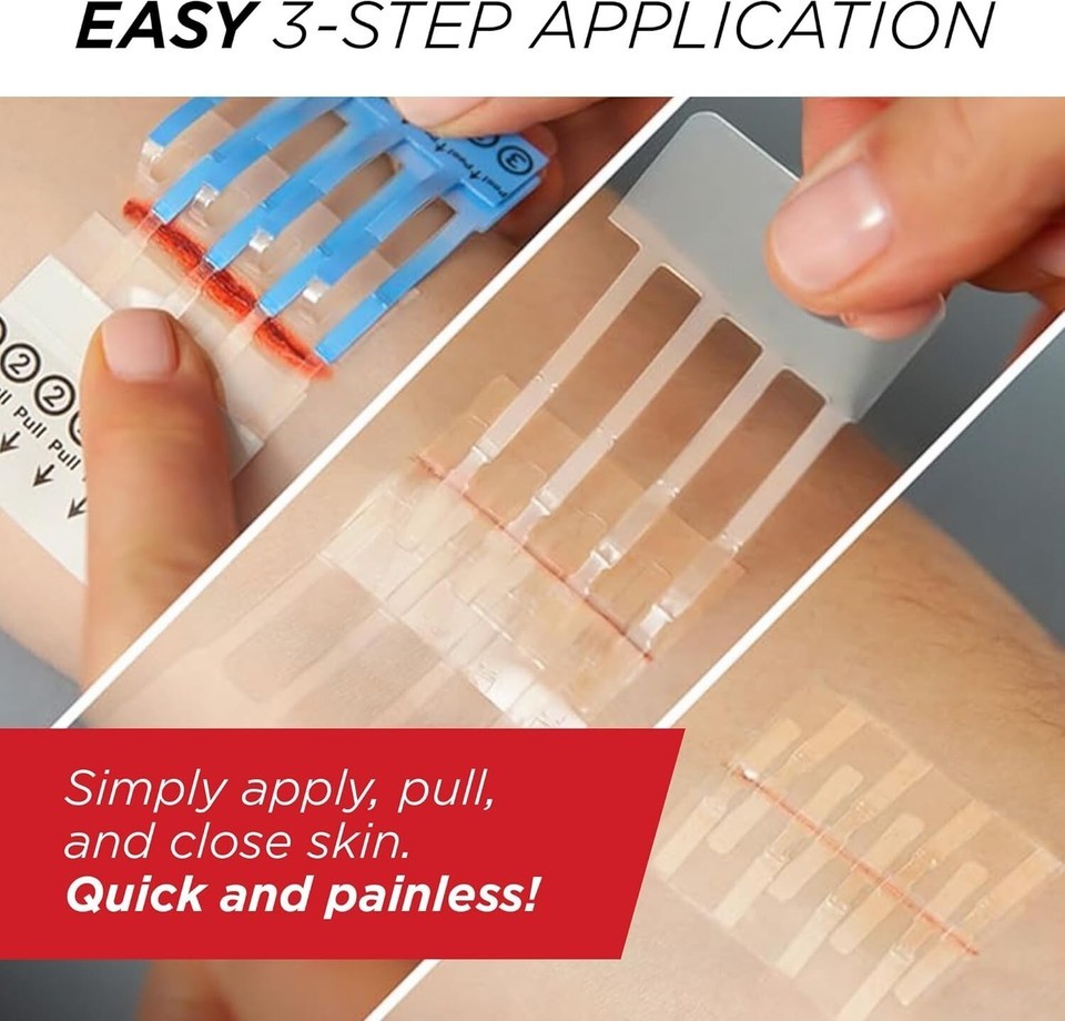 3 Pack Non-Invasive Skin Closure Device – Easy Application, Great for Kids Item image 7