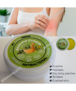 Dermatitis Eczema Cream Antibacterial Itchy Rash Dry Skin Rosacea Treatm... - $39.77 CAD