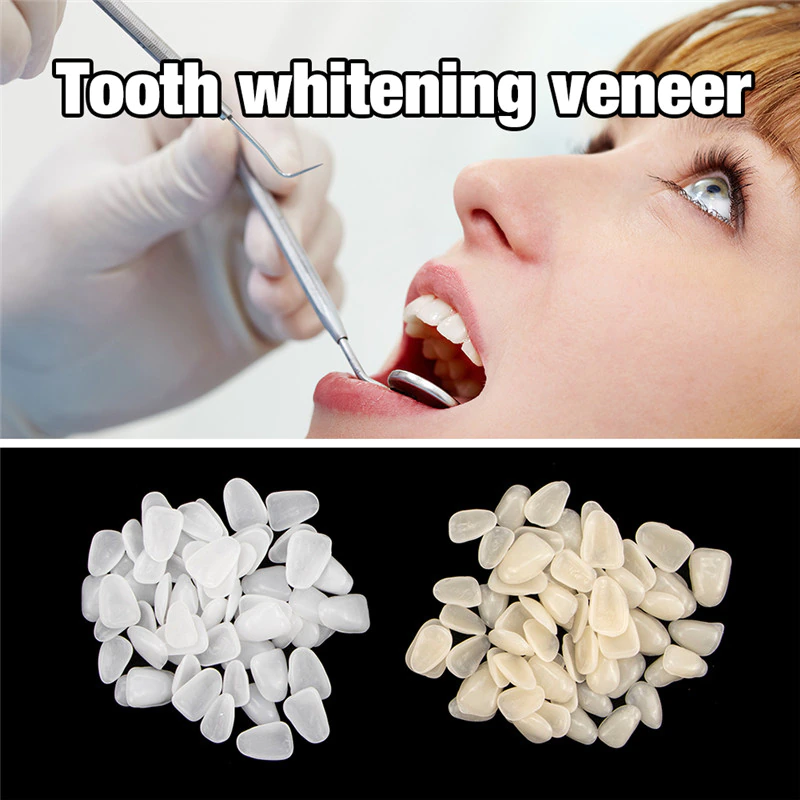 70pcs Dental Veneer Resin Temporary Crown Teeth Whitening Oral Care Toot... - £11.04 GBP