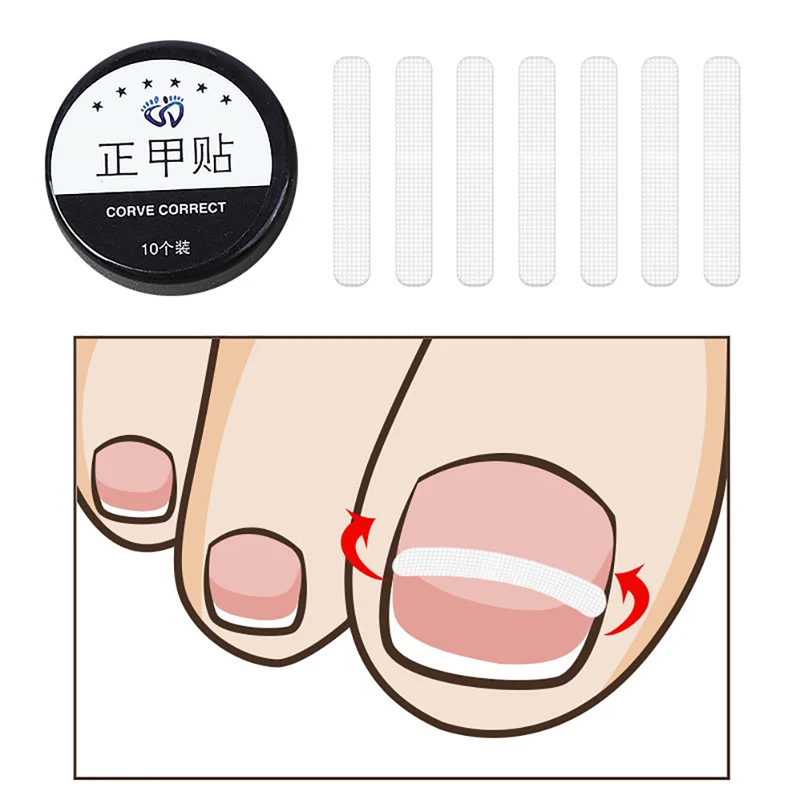 New Ingrown Toe Nail Treatment Ingrown Toenail Correction Tool Elastic Patch - £8.41 GBP