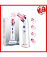 Professional Blackhead Remover Vacuum - USB Rechargeable with LED Displa... - $44.06 CAD